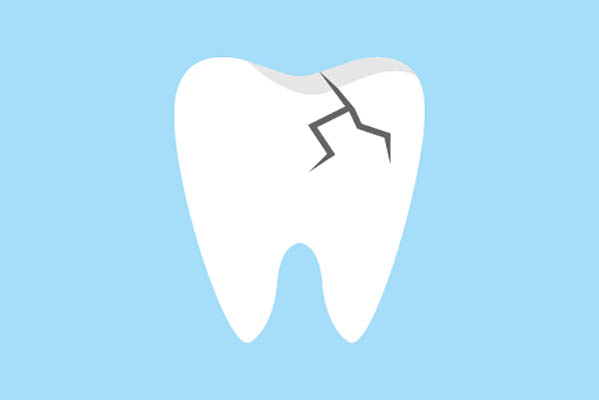 What Can A Dentist Do For A Broken Tooth?