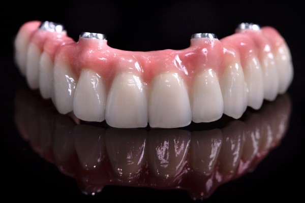 Overdentures Supported By Dental Implants