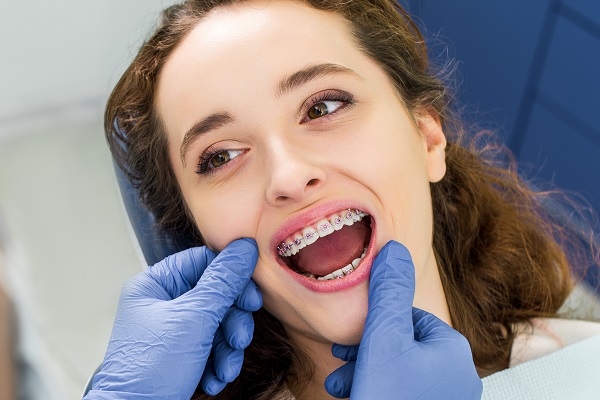 Choosing The Right Teeth Straightening Option For Me